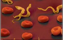 Как понять что в организме есть паразиты: симптомы и признаки гельминтов