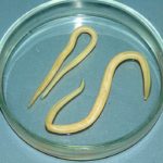 Паразити в печени человека: симптоми и лечение, какие ето гельминти и черви, как их вивести