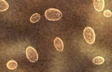 Яйца глистов в кале: как выглядят у человека (фото), симптомы и лечение