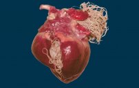Сердечные глисты у человека: могут ли паразиты жить в сердце