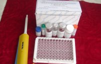 ИФА анализ крови: расшифровка при паразитах