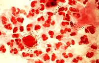 Ифа анализ крови на паразитов где сдать в спб — Обсуждение