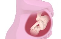 Трихомониаз и беременность