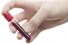 Анализ крови на эхинококк: норма антител и расшифровка