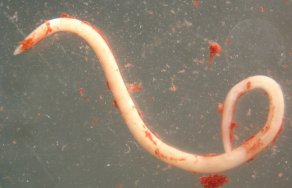 Анизакиды: симптомы, лечение и фото червей в человеке