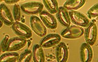 Яйца гельминтов в кале: фото, как выглядят гельминты под микроскопом+++