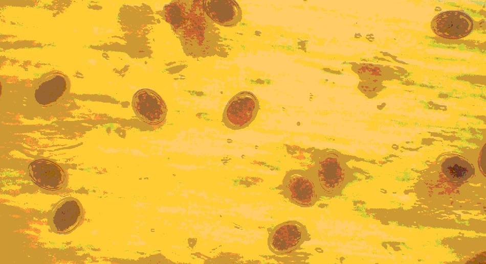 Яйца глистов под микроскопом фото