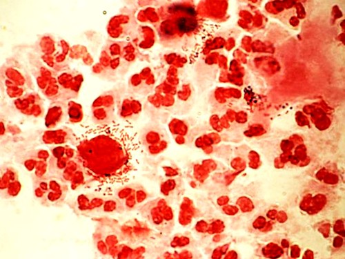 Ифа анализ крови на паразитов где сдать в спб - Обсуждение