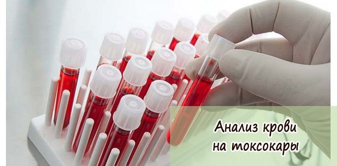 Анализ крови на антитела к гельминтам, антигены глистов