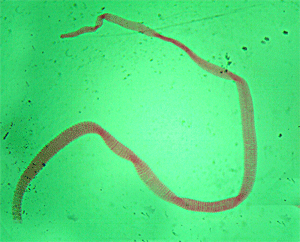 Лентовидный червь. Ленточные черви карликовый цепень. Ленточные черви паразиты карликовый цепень. Hymenolepis Nana под микроскопом. Карликовый цепень биогельминт.