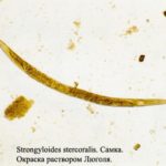 круглый червь Strongyloides stercoralis. 