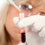 анализ крови на амебиаз