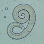 трихинелла Trichinella spiralis