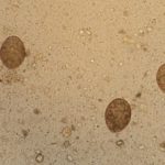 микроскопическое исследование кала на яйца и личинки гельминтов