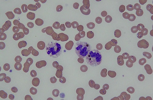 Малярийный паразит обитает в организме человека в лимфе - Статьи