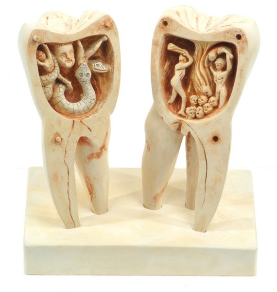 Черви в зубах правда или вымысел, консультации стоматологов, регулярная чистка зубов и обязательный врачебный профилактический контроль