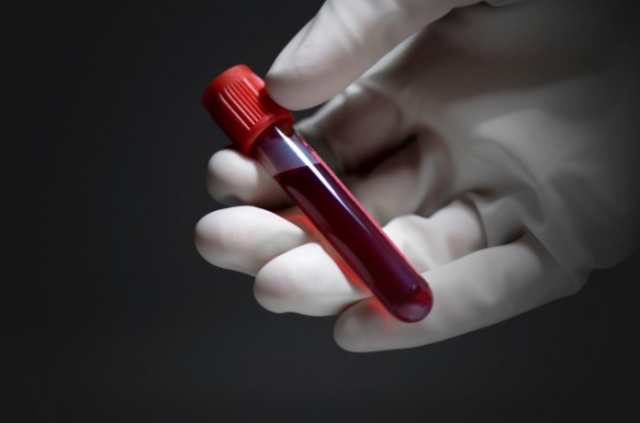 Почему анализ крови на глисты делать Инвитро