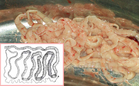 Глисты гельминты, живущие в мышцах человека, симптомы и фото