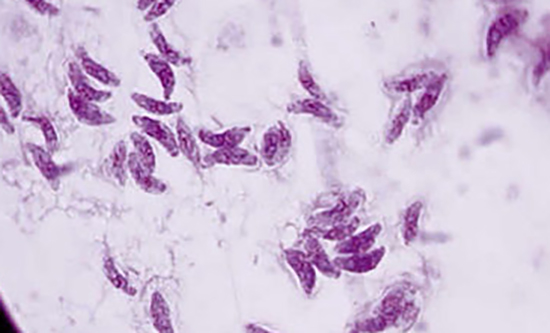 Простейшие-паразиты человека Малярийный плазмодий и дизентерийная амёба