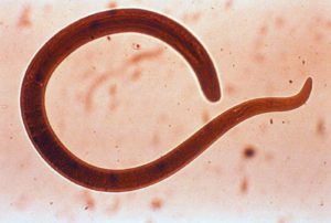 Как диагностируют паразитов в организме человека - симптомы, методы и какие анализы нужно сдавать